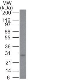 Bcl-2 Monoclonal Mouse Antibody (100/D5)
