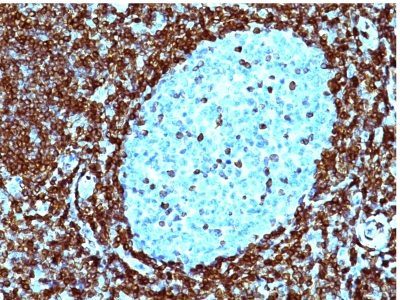 Bcl-2 Monoclonal Mouse Antibody (124)