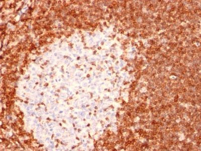 Bcl-2 Monoclonal Mouse Antibody (8C8)