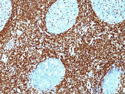 Bcl-2 Monoclonal Mouse Antibody (BCL2/782 + BCL2/796)