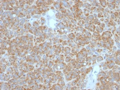 Bcl-2 Monoclonal Mouse Antibody (BCL2/782 + BCL2/796)