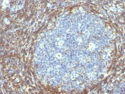 Bcl-2 Monoclonal Mouse Antibody (BCL2/782)