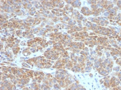 Bcl-2 Monoclonal Mouse Antibody (BCL2/782)