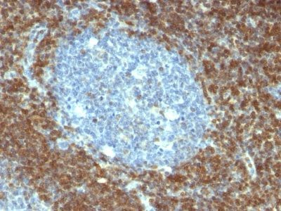 Bcl-2 Monoclonal Mouse Antibody (BCL2/796)