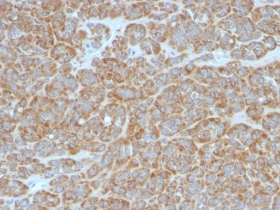 Bcl-2 Monoclonal Mouse Antibody (BCL2/796)
