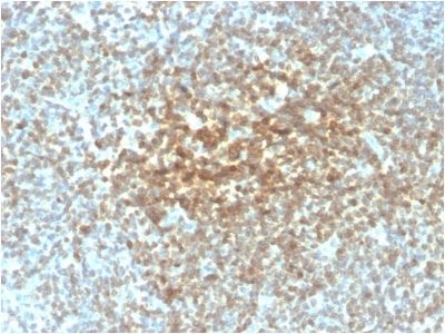 Bcl-2 Recombinant Monoclonal Mouse Antibody (rBCL2/782)