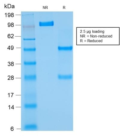 Bcl-2 Recombinant Monoclonal Mouse Antibody (rBCL2/782)