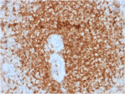 Bcl-2 Recombinant Monoclonal Mouse Antibody (rBCL2/796)