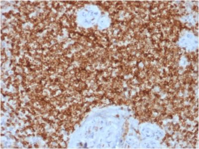 Bcl-2 Recombinant Monoclonal Rabbit Antibody (BCL2/1878R)