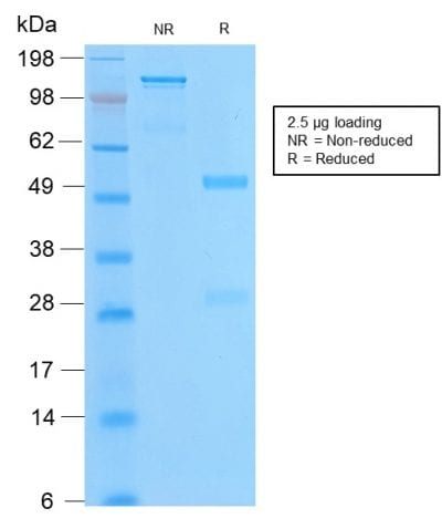 Bcl-2 Recombinant Monoclonal Rabbit Antibody (BCL2/2210R)