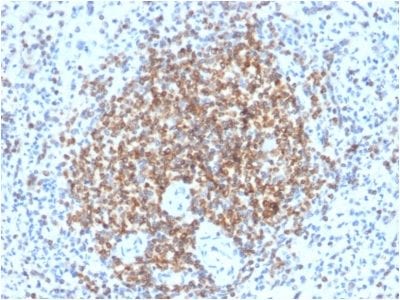 Bcl-2 Recombinant Monoclonal Rabbit Antibody (BCL2/2210R)