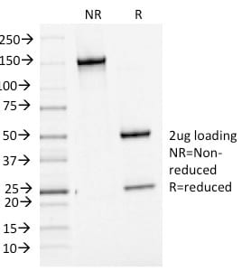 Bcl-6 Monoclonal Mouse Antibody (BCL6/1475)