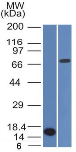 Bcl-6 Monoclonal Mouse Antibody (BCL6/1475)