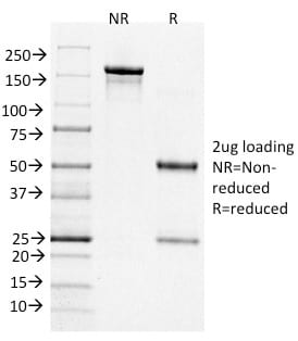 Bcl-6 Monoclonal Mouse Antibody (BCL6/1526)