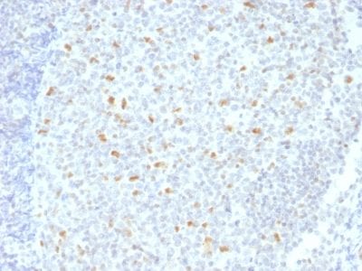 Bcl-6 Monoclonal Mouse Antibody (BCL6/1526)