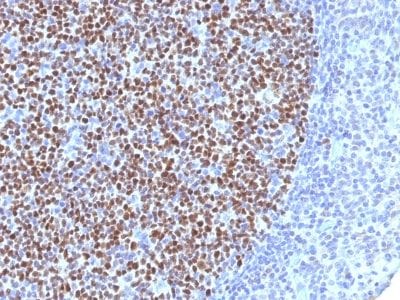 Bcl-6 Monoclonal Mouse Antibody (BCL6/1527)