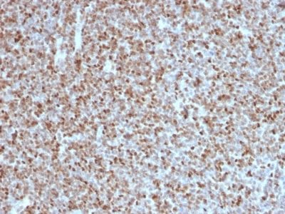 Bcl-6 Monoclonal Mouse Antibody (BCL6/1527)