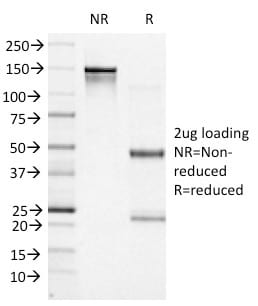 Bcl-6 Monoclonal Mouse Antibody (BCL6/1527)