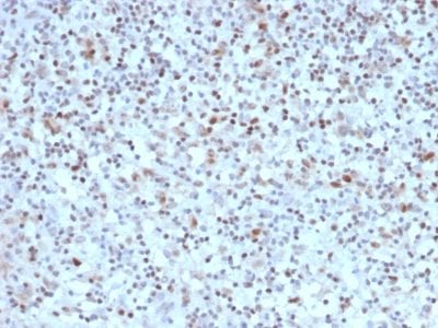 Bcl-6 Monoclonal Mouse Antibody (BCL6/1527)