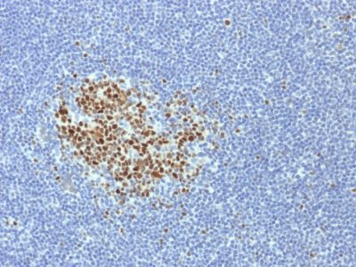 Bcl-6 Monoclonal Mouse Antibody (BCL6/1718)