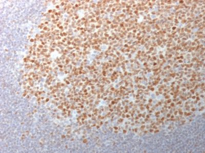 Bcl-6 Monoclonal Mouse Antibody (BCL6/1982)