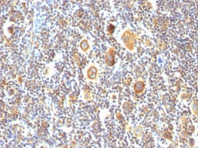 Bcl-6 Monoclonal Mouse Antibody (BCL6/850)