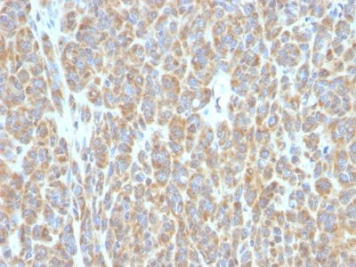 Bcl-6 Monoclonal Mouse Antibody (BCL6/850)