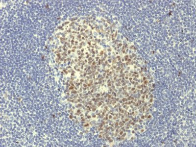 Bcl-6 Monoclonal Rabbit Antibody (BCL6/1951R)