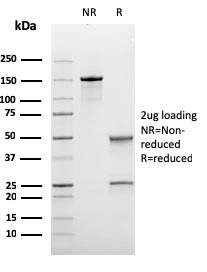 Bcl-6 Recombinant Monoclonal Mouse Antibody (rBCL6/1475)