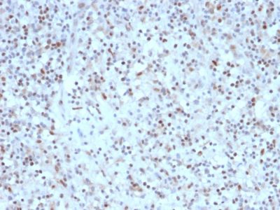 Bcl-6 Recombinant Monoclonal Mouse Antibody (rBCL6/1527)