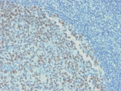 Bcl-6 Recombinant Monoclonal Mouse Antibody (rBCL6/1718)