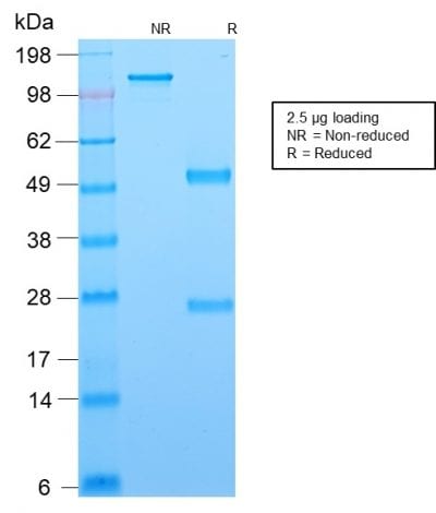Bcl-6 Recombinant Monoclonal Mouse Antibody (rBCL6/1718)