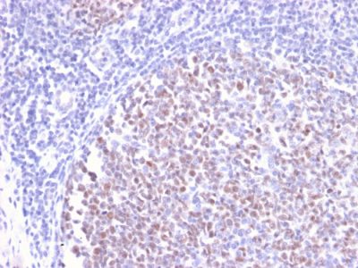 Bcl-6 Recombinant Monoclonal Rabbit Antibody (BCL6/2497R)