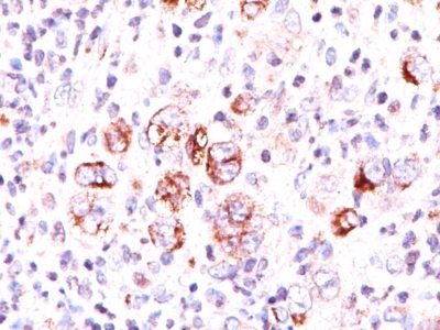 Bcl-x Monoclonal Mouse Antibody (2H12)