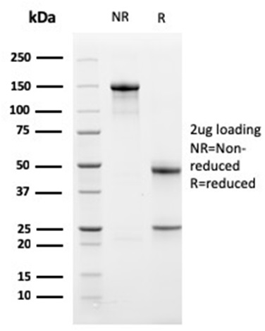 Bcl-x Monoclonal Mouse Antibody (BCL2L1/1762)