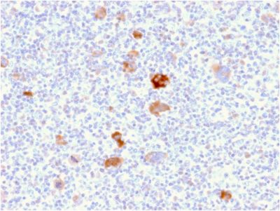 Bcl-x Monoclonal Mouse Antibody (BCL2L1/2406)