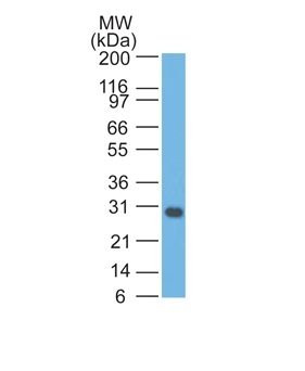 Bcl-x Monoclonal Mouse Antibody (BX006)