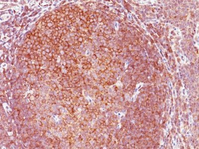 Bcl10 Monoclonal Mouse Antibody (BL10/411)