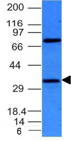 Bcl10 Monoclonal Mouse Antibody (BL10/411)