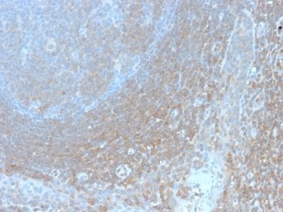 Bcl10 Recombinant Monoclonal Rabbit Antibody (BL10/2988R)