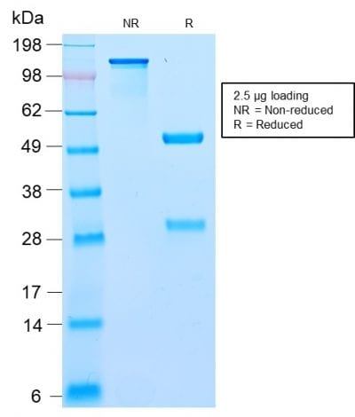 Bcl10 Recombinant Monoclonal Rabbit Antibody (BL10/2988R)