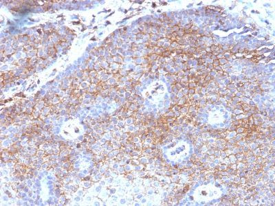 Beta-2 Microglobulin Monoclonal Mouse Antibody (B2M/1118)