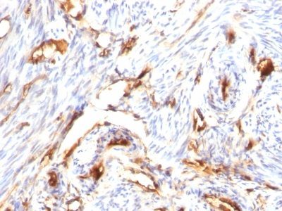 Beta-2 Microglobulin Monoclonal Mouse Antibody (B2M/1118)