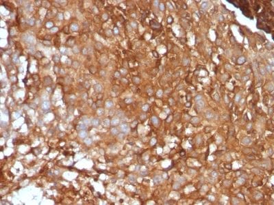 Beta-2 Microglobulin Monoclonal Mouse Antibody (B2M/961)