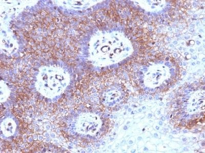 Beta-2 Microglobulin Monoclonal Mouse Antibody (B2M/961)