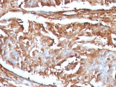 Beta-2 Microglobulin Monoclonal Mouse Antibody (B2M/961)