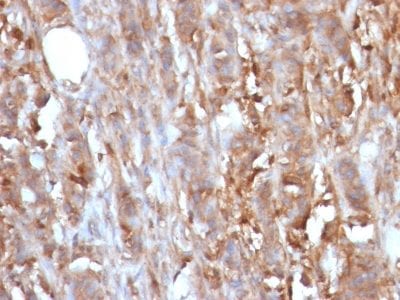 Beta-2 Microglobulin Monoclonal Mouse Antibody (B2M/961)