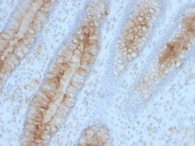 Beta-2 Microglobulin Monoclonal Mouse Antibody (B2M/961)