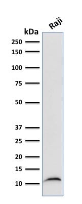 Beta-2 Microglobulin Monoclonal Mouse Antibody (B2M/961)