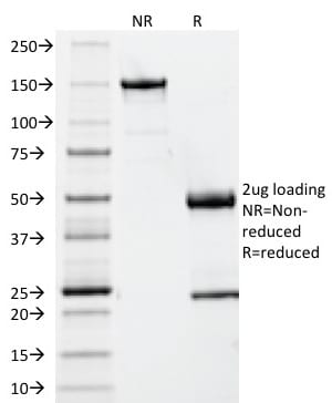 Beta-2 Microglobulin Monoclonal Mouse Antibody (B2M/961)